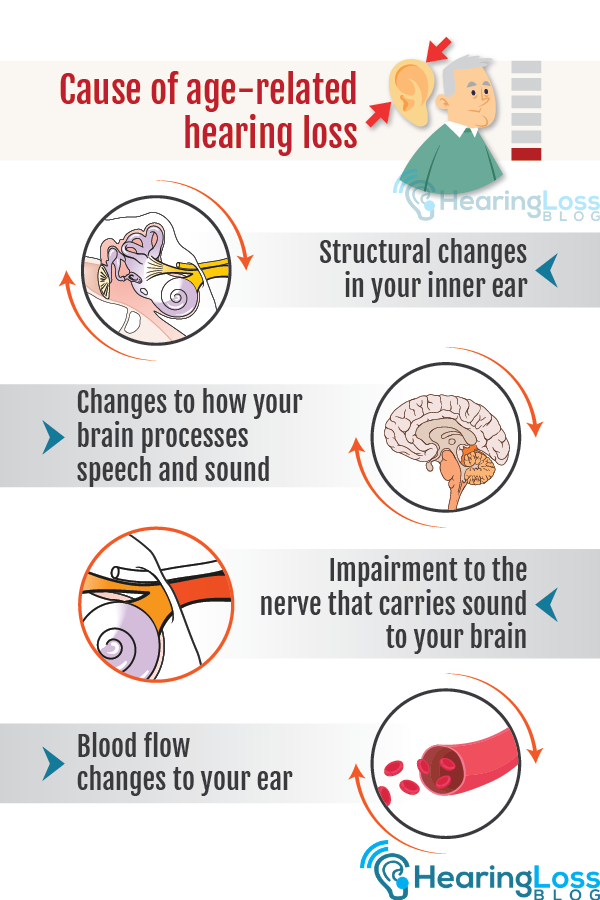 Age Related Hearing Loss Symptoms, Causes | Hearing Loss Treatment